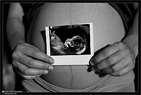 pregnant woman with sonogram